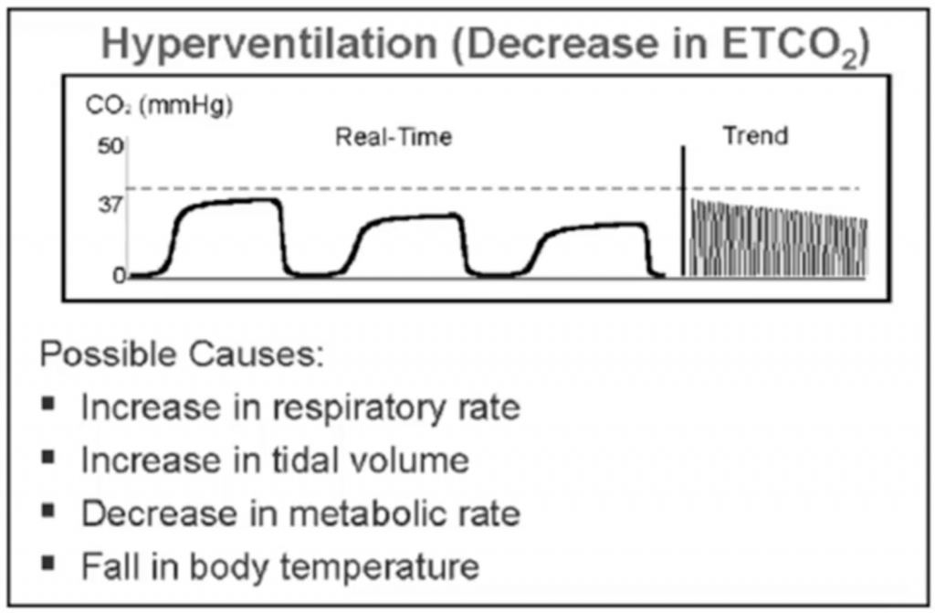 normal end tidal co2