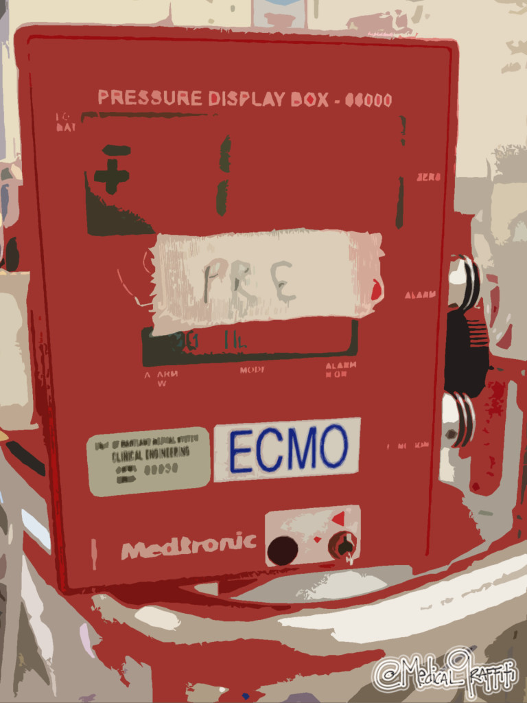 Anatomy of an Percutaneous ECMO Cannulation (Femoral Vein Cannulation)