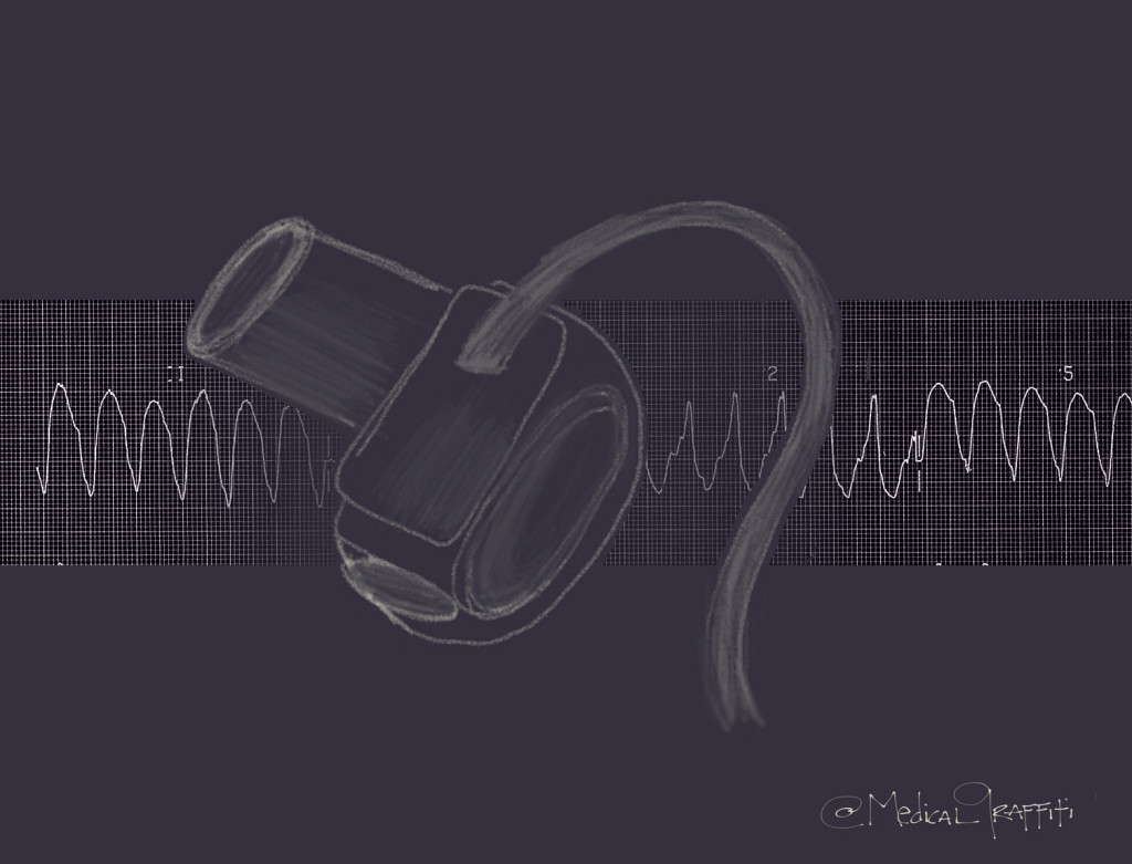 Ventricular Arrhythmias in the LVAD Patient