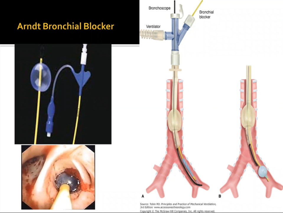 Fouad – Managing Massive Hemoptysis