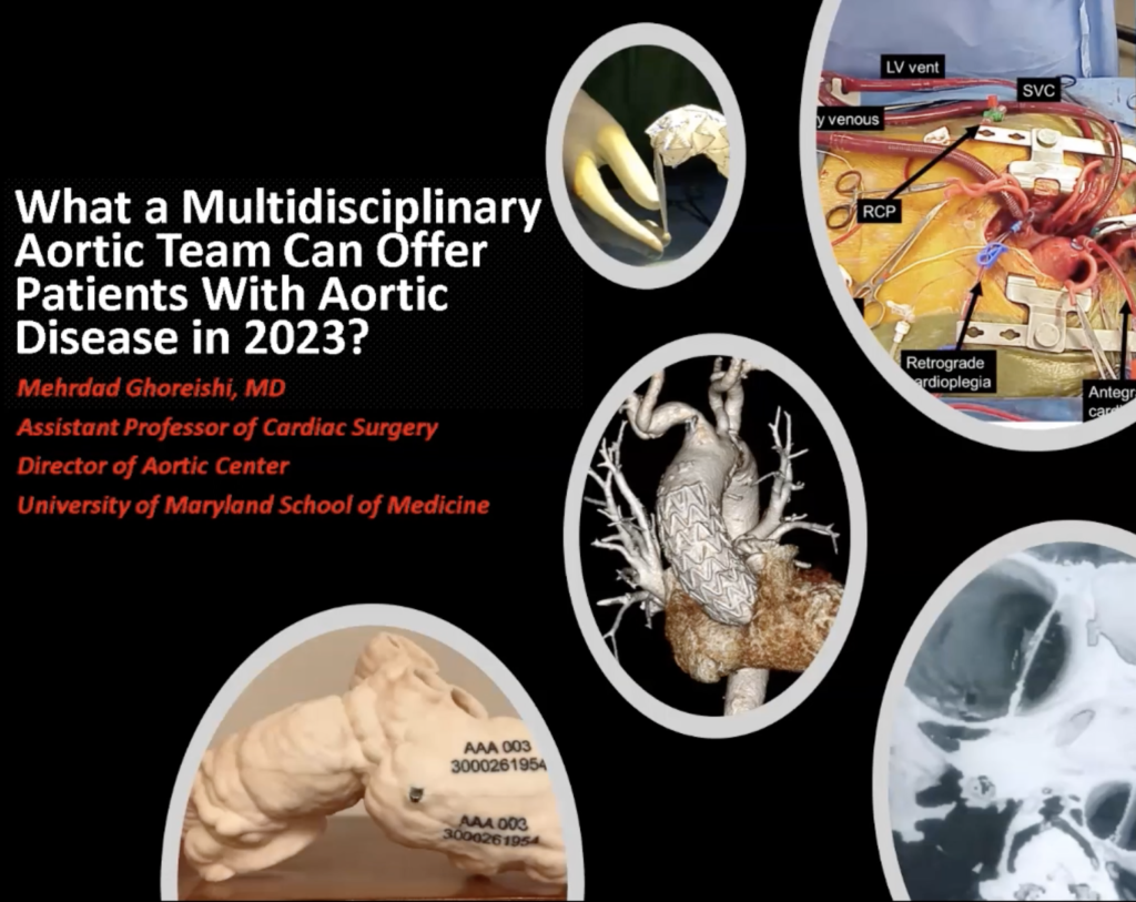 Ghoreishi – What a Multidisciplinary Aortic Team Can Offer Patients with Aortic Disease in 2023